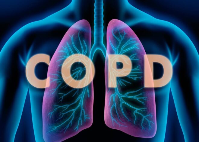 COPD: How to Understand and Live With It