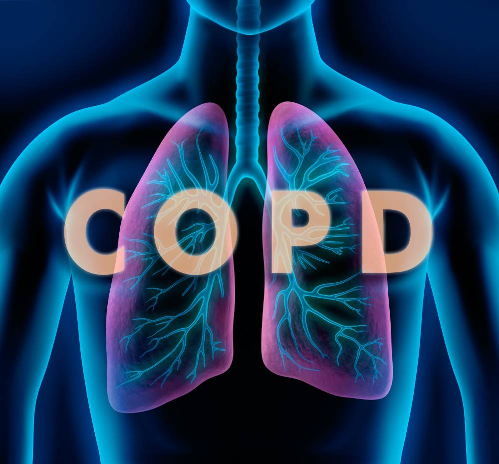 COPD: How to Understand and Live With It