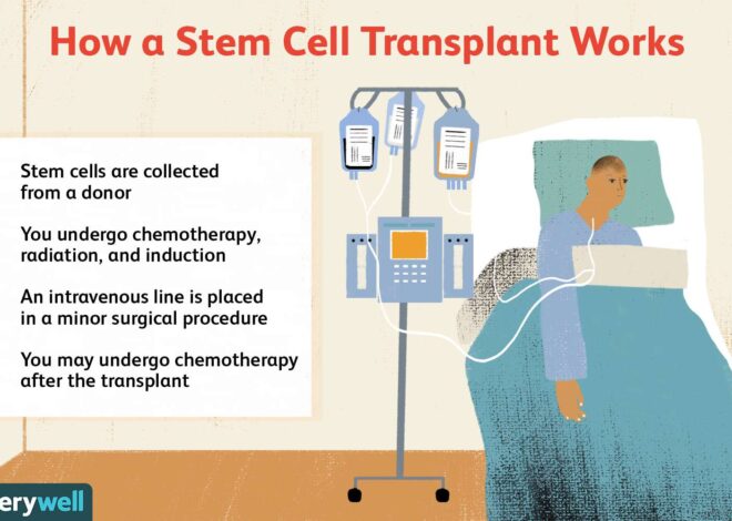 Stem Cell & Bone Marrow Transplants for Leukemia, Lymphoma, Myeloma