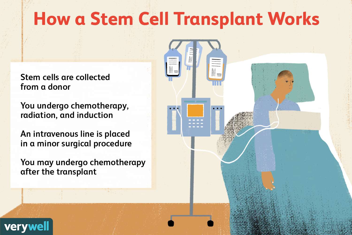 Stem Cell & Bone Marrow Transplants for Leukemia, Lymphoma, Myeloma